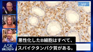 ライアン・コール博士が「ワクチンと癌の関係」について。スパイクタンパクがすべての悪化したB細胞にある！