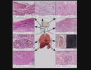 A.D.E（抗体依存性感染増強）を全く説明 せずに接種を進めた政府と製薬会社と医師達