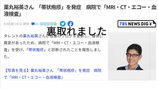 裏取れました  薬丸裕英さん　「帯状疱疹」を発症　病院で「MRI・CT・エコー・血液検査」