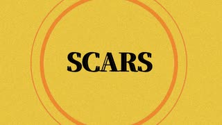 SCARS - X JAPAN【知声、ナクモカバー】