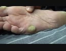 右足たこ：help me Japan　Please subscribe to our channel.
