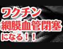 【衝撃論文】ワクチン接種者は眼血栓が2.19倍！