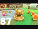 【のんびり実況】星のカービィ ディスカバリー【PART87】