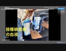 【閲覧注意】ワクチン接種後、障害で苦しんでいる女性歌手の血液に紐のようなもの。酷すぎる。