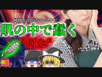 【2011年】顔の中で蠢く"ナニカ"ただのニキビだと思ったら…OLを襲った原因不明の症状 その意外な正体とは？【ゆっくり解説】