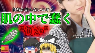 【2011年】顔の中で蠢く"ナニカ"ただのニキビだと思ったら…OLを襲った原因不明の症状 その意外な正体とは？【ゆっくり解説】