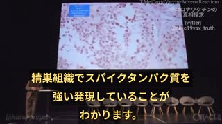 アルネ・ブルクハルト博士：ワクチン死亡者解剖結果。精巣にスパイクタンパク質たくさんあり、精母細胞がほとんどない！