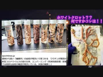 接種者からホワイトクロット？なんですかコレ...
