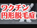 【海外論文】ワクチン接種後に円形脱毛症を発症した女性