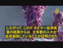 新型コロナワクチンを接種すべきでない理由は何か? 新型コロナワクチンを接種した患者で4～7日後にD-ダイマー血液検査を行った結果、62%が血栓形成