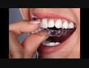 Best Wisdom Teeth Extraction