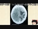 ゆっくりと一緒にSCPを紹介したい！その156【SCP】