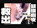 カラー版【本物耳かきASMR】鼓膜痂皮を鼓膜前ポケットから救出する！/精密ドライバー/ピンセット/癒しの耳掃除/イヤースコープ/激しい痒み/引掻き音