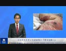 コロナワクチンの安全性に「重大な疑い」