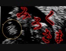 【ゆっくり解説】██が人間に寄生？その理由は… SCP-3693-JP みろくさま