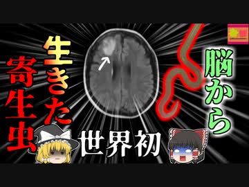 【2022年】脳から8cmの"生きた寄生虫"  健忘・鬱・腹痛・頭痛などの謎の症状に襲われていた女性の悲劇『オピダスカリス・ロベルティ』【ゆっくり解説】