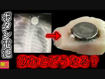 【2021年】飲み込めば10分で肉を溶かす身近で小さな"あるモノ"　幼女の命を奪った小さな電池 【ゆっくり解説】