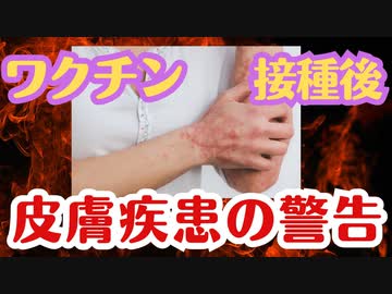 【論文】ワクチン接種後に皮膚疾患が増えている？