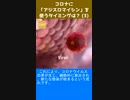 コロナに「アジスロマイシン」を使うタイミングは？ (3)
