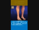 ドイツのウイルス学教授であるスチャリ・バクディ博士によれば、mRNAワクチンが血栓を引き起こすのは必然であり、疑う余地はないという-2