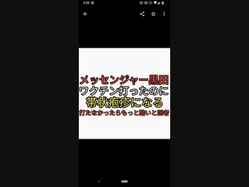 メッセンジャー黒田がワクチン打ったのに帯状疱疹になる。医者の言い訳がヤバすぎる。ワクチン後遺症。免疫力下がる
