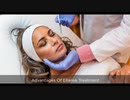 Ellanse Treatment