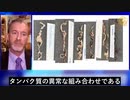 病理学者が語るmRNAワクチン接種者の血栓とフィブリン分解酵素「ナットウキナーゼ」の使用について
