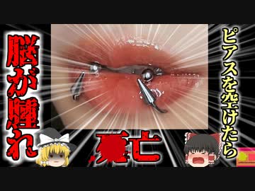 【2022年】女性「安いわね！ここでピアスあけてみよう」→激安違法クリニックの施術で脳が腫れて4亡【ゆっくり解説】