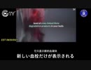 mRNAワクチンが人体の細胞に与える影響-3