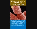 豪のマルコム・ロバーツ上院議員：ワクチン汚染、深刻 4-2