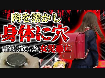 【2020年】『少女の命を奪った小さな銀色 5日間地獄の苦しみを味わった末に亡くなった少女が飲み込んでいた"肉を溶かすあるモノ"　身近な製品の恐ろしい一面　【ゆっくり解説】