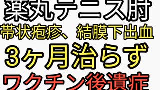 ワクチン後遺症は治らない。地獄に突き落とした日本政府。薬丸裕英テニス肘、帯状疱疹、結膜下出血が再発。