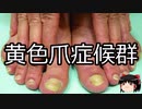 【ゆっくり朗読】ゆっくりさんと不思議な病気 その618