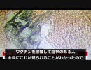 接種者血液中の酸化グラフェンが赤血球を凝集･変形し､心疾患や血栓症の原因となる。