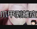 【ゆっくり朗読】ゆっくりさんと不思議な病気 その622