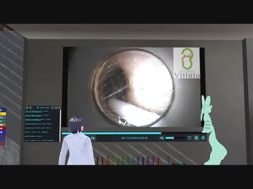 【耳垢掃除リアクション解説】耳掃除 vol.151「死闘の末、ギブアップ　あとは耳鼻科で…〜左耳編〜」(ear wax removal)イヤーエステサロンVillalo～ヴィラロ～