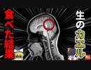 【2014年】原因は「生のカエル」？6年以上悩まされた"謎の頭痛" MRIに映っていた白い糸 『マンソン裂頭条虫脳症』【ゆっくり解説】