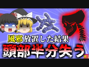 【2021年】「いつもの風邪かなぁ」→脳が溶連菌だらけになり頭蓋骨の半分を失った女性 『副鼻腔炎溶連菌感染症』【ゆっくり解説】