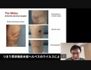 【mRNAワクチンという人類の脅威】 〜DNA汚染とレプリコンワクチンの危険性〜［ダイジェスト前編］
