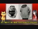 【戦前日本】奇形児が辿った運命