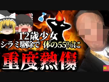 【2016年】シラミ駆除剤で火だるまになった少女 12歳で体の55%に重度熱傷を負い変わり果てた姿になり、100回以上の手術…【ゆっくり解説】