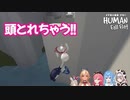 頭とれちゃう！！　