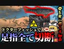 【2010年】綺麗になるハズの”ドクターフィッシュ”で骨を食い尽くすバクテリアに感染 足の指をすべて失ってしまった女性『シュワネラ菌感染症』【ゆっくり解説】