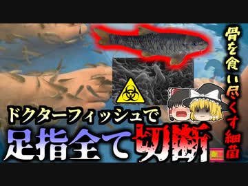 【2010年】綺麗になるハズの”ドクターフィッシュ”で骨を食い尽くすバクテリアに感染 足の指をすべて失ってしまった女性『シュワネラ菌感染症』【ゆっくり解説】