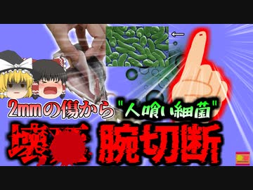 【2021年】魚が刺さった2mmの傷が原因で腕が腐り切断…”ヒト喰いバクテリア”『ビブリオ・バルフィニカス感染症』【ゆっくり解説】