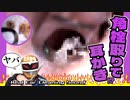 【激ヤバ閲覧注意】本物耳かきイヤースコープ/角栓取り