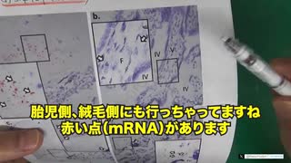 鹿先生：胎児側にもコロナワクチンのmRNAが行ってる証拠が見つかった