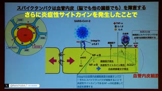 脳神経外科医の濱﨑清利 医師：コロナに罹患しなくても、コロナワクチンでも同じ作用機序で血液脳関門が破綻する