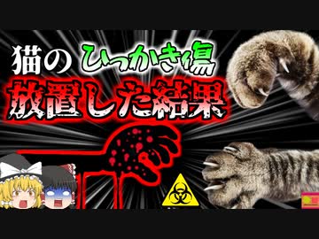 【2019年】「痛っ！」猫の引っかき傷から細菌が侵入 皮膚組織が溶け落ちる「壊〇性筋膜炎」で生死の境を境をさまよった女性【ゆっくり解説】