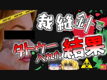 【2022年】「安上がりだし自分でやっちゃおう」→縫い針でタトゥーを入れた女性 感染症で目が見えなくなるほど顔が腫れ…【ゆっくり解説】